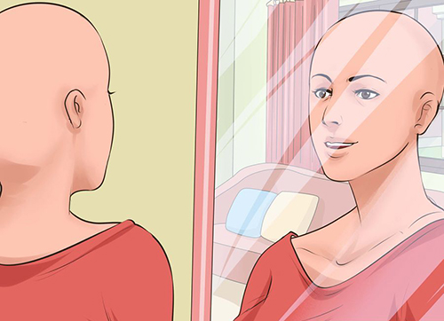 how to be confident with hairloss