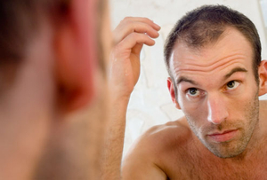 Hair Loss DHT theory